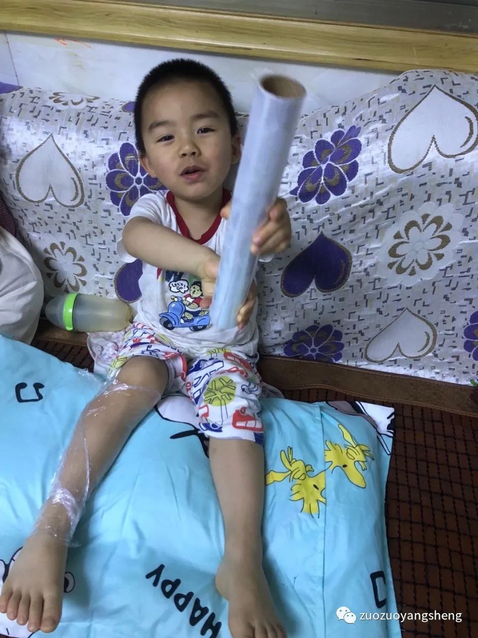 案例分享:原始点调理3岁小孩右腿骨折案例 案例分享:原始点调理3岁小孩右腿骨折案例