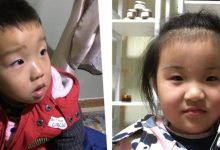 案例分享:原始点让我摆脱了打针吃药的痛苦(原始点调理两孩子哮喘、咳嗽的案例)-原始点全球同学网