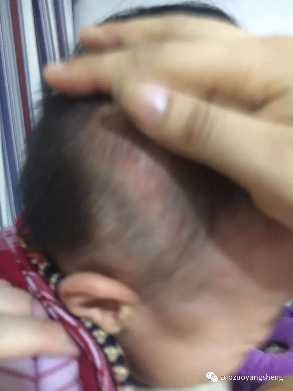 原始点调理幼儿咳嗽后出现严重好转反应