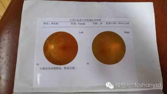 案例分享：原始点调理后减肥的案例