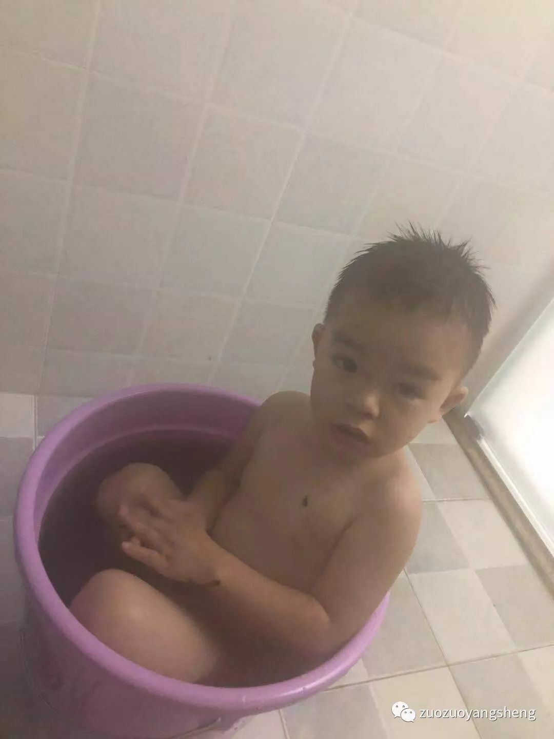 案例分享：原始点调理小孩水痘与右腿扭伤无法下地案例