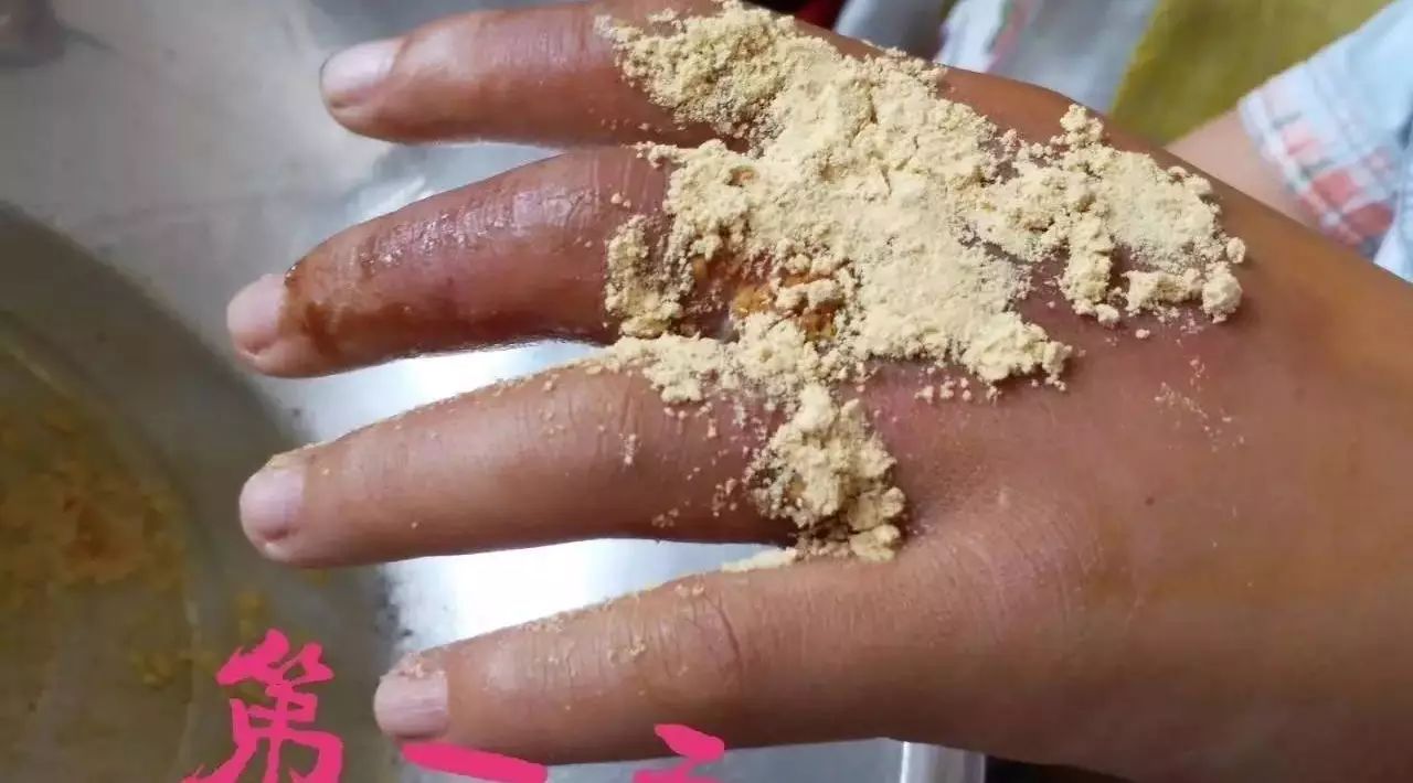 案例分享：原始点调理小朋友手部烫伤的案例-原始点全球同学网