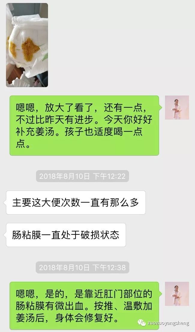 案例分享:原始点调理三个月宝宝腹泻、便血的案例 案例分享:原始点调理三个月宝宝腹泻、便血的案例