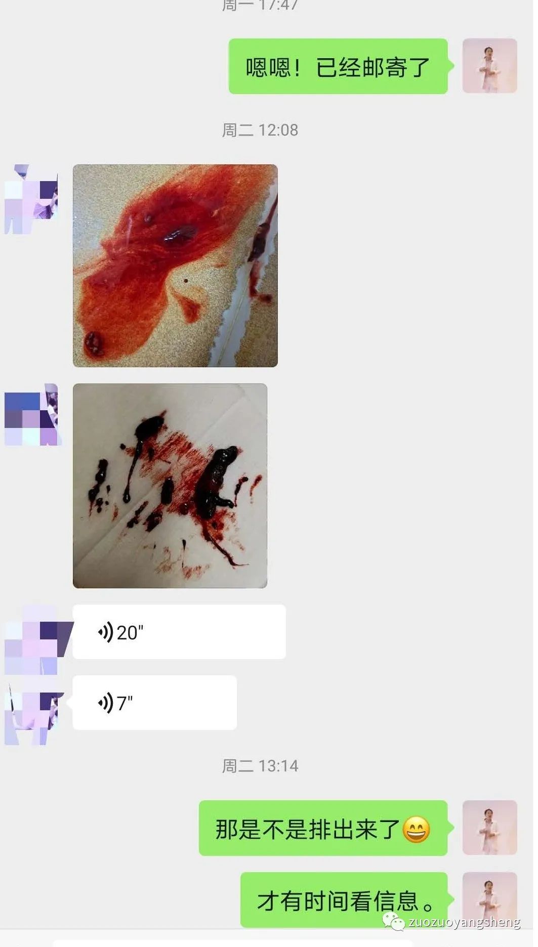 案例分享:原始点调理三天排死胎的案例。 案例分享:原始点调理三天排死胎的案例。