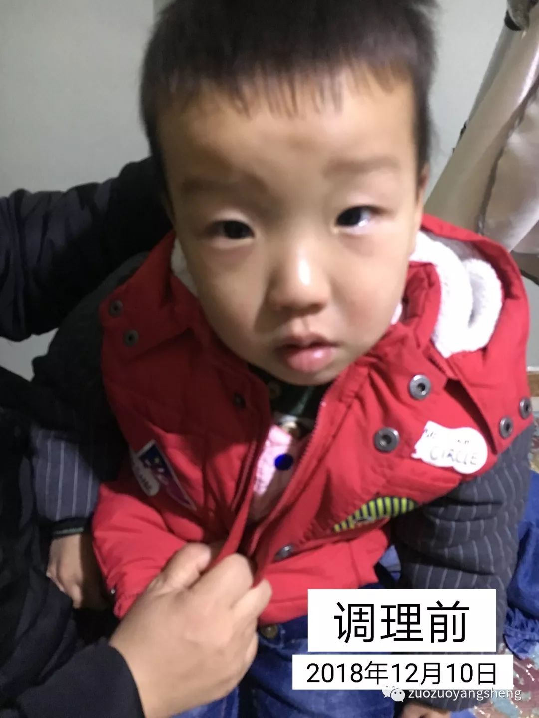 案例分享:原始点让我摆脱了打针吃药的痛苦(原始点调理两孩子哮喘、咳嗽的案例) 案例分享:原始点让我摆脱了打针吃药的痛苦(原始点调理两孩子哮喘、咳嗽的案例)