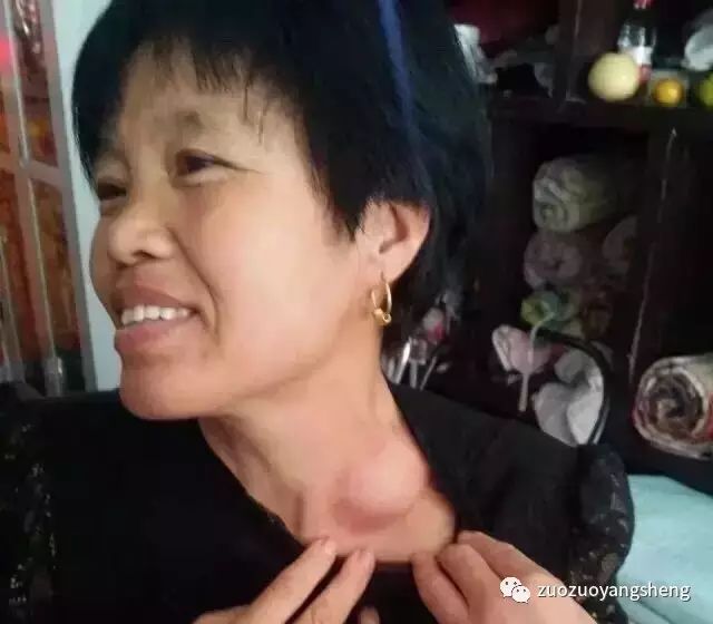 案例分享：原始点调理淋巴癌的案例-原始点全球同学网