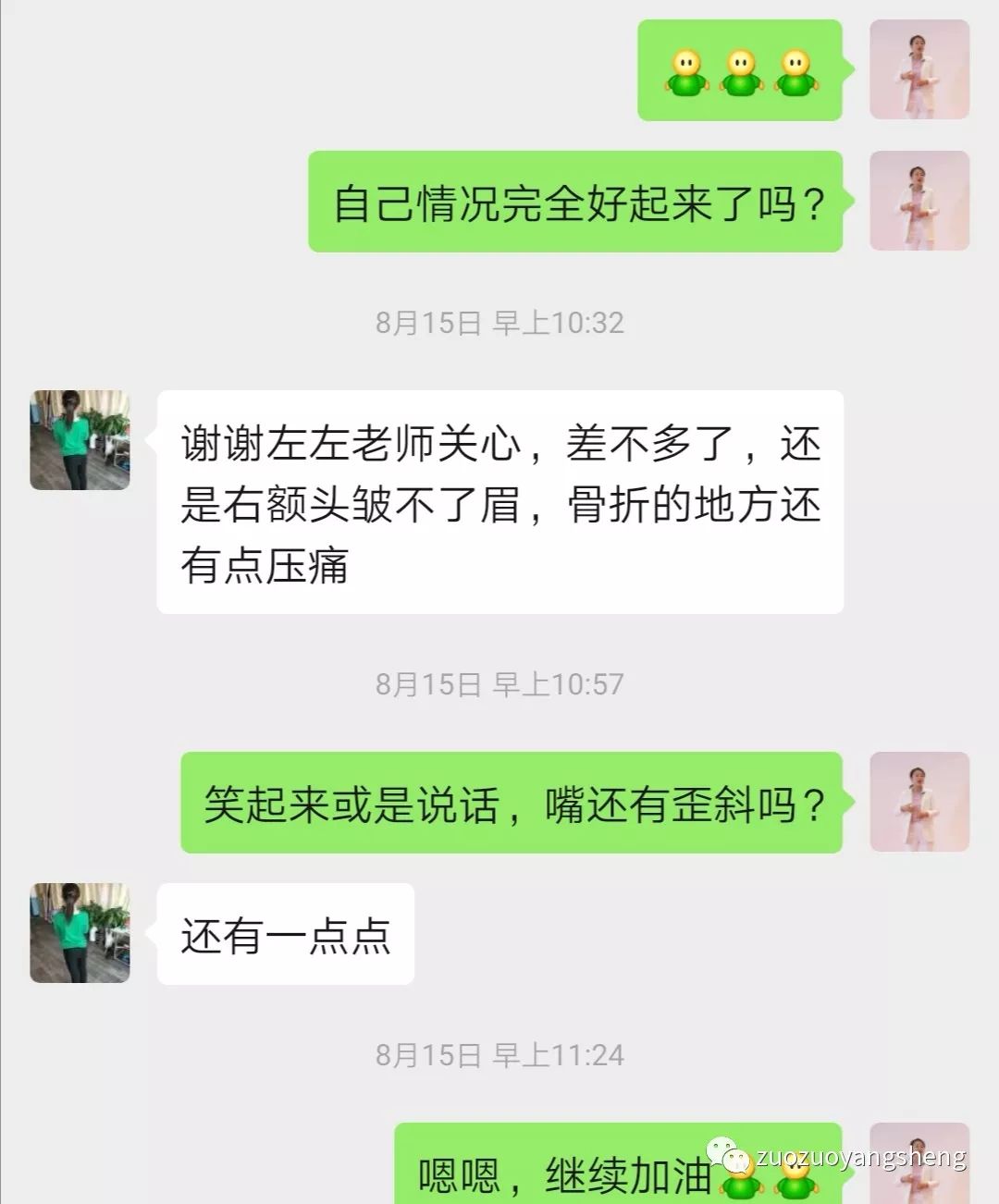 原始点调理因车祸出现的面瘫案例 原始点调理因车祸出现的面瘫案例