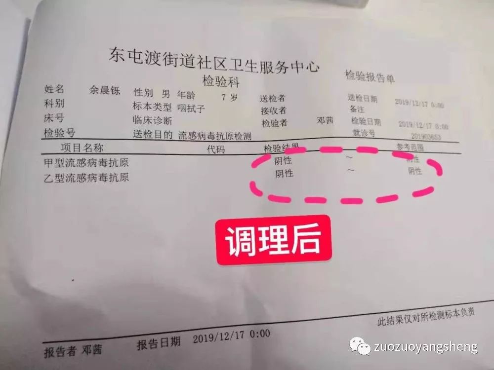 案例分享：原始点调理甲流案例