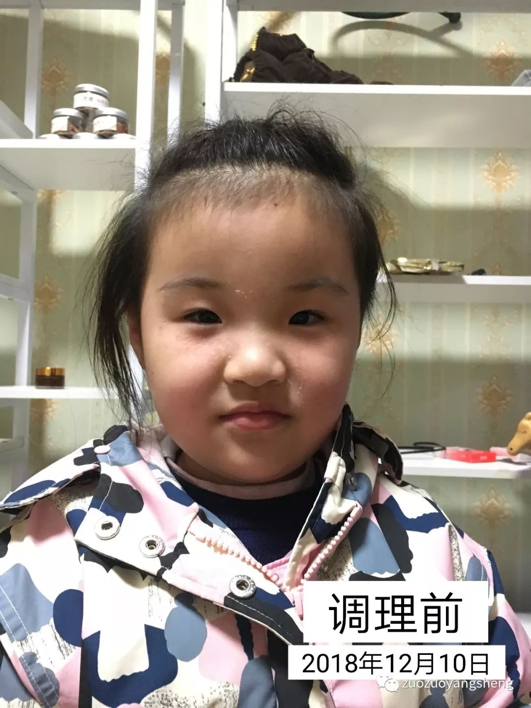 案例分享:原始点让我摆脱了打针吃药的痛苦(原始点调理两孩子哮喘、咳嗽的案例) 案例分享:原始点让我摆脱了打针吃药的痛苦(原始点调理两孩子哮喘、咳嗽的案例)