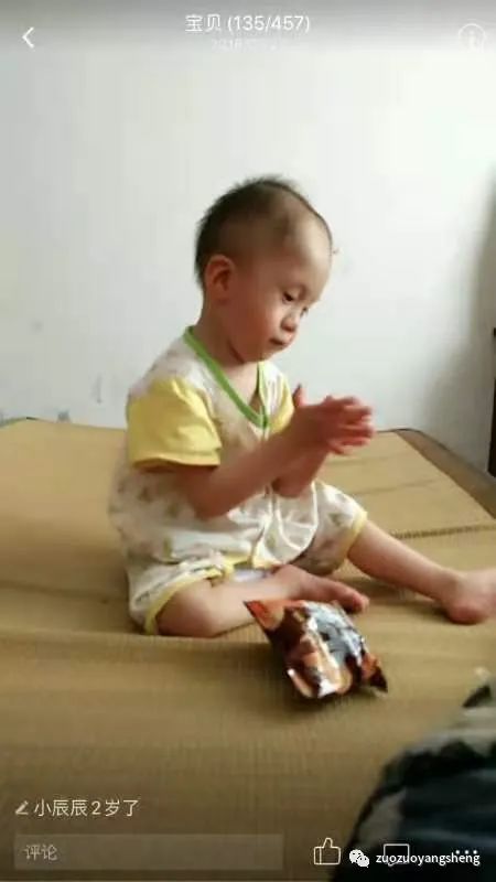 案例分享：原始点调理脑瘫患儿的案例分享