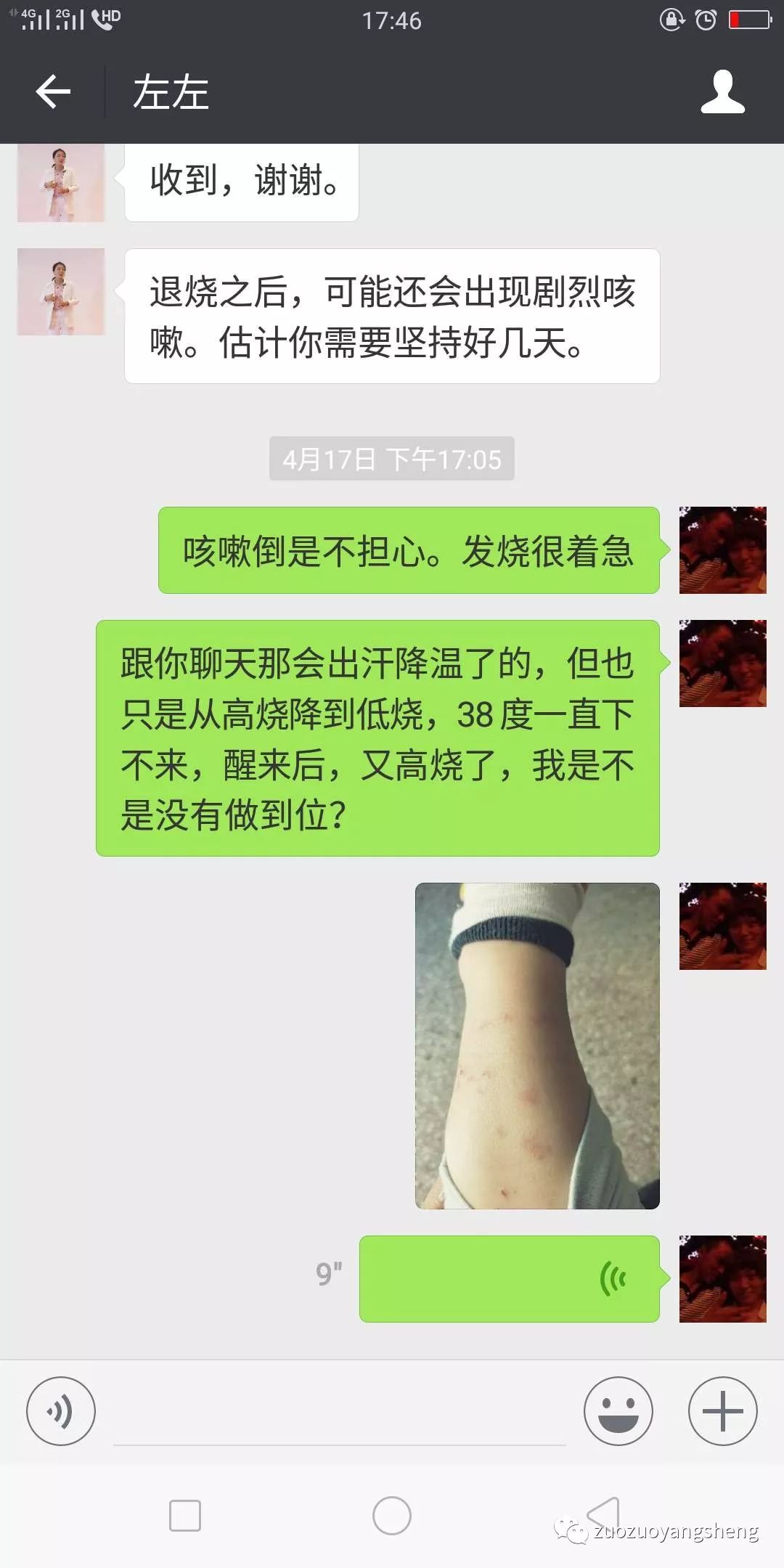 案例分享：原始点调理孩子反复高烧的案例