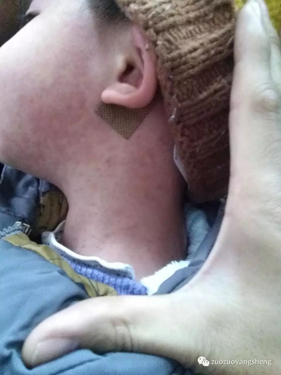 案例分享：原始点调理小朋友的婴幼儿急疹案例