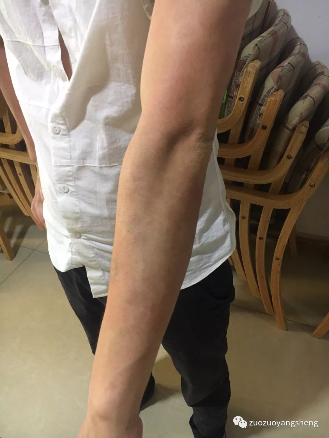 案例分享:原始点调理十几年牛皮癣的案例 案例分享:原始点调理十几年牛皮癣的案例