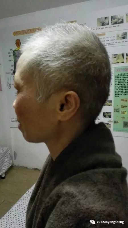 案例分享:原始点调理乳癌的成功案例 案例分享:原始点调理乳癌的成功案例