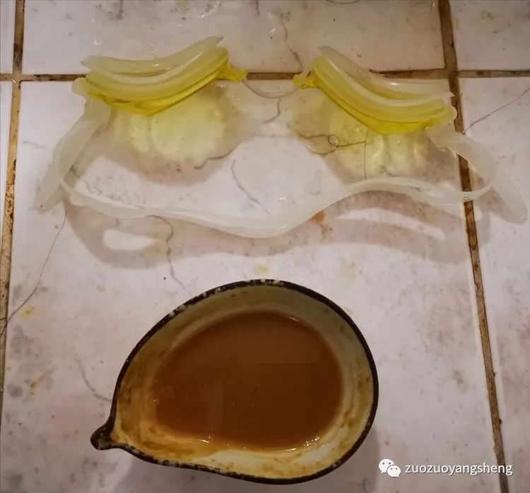 案例分享:原始点调理视力下降、视物模糊的案例 案例分享:原始点调理视力下降、视物模糊的案例