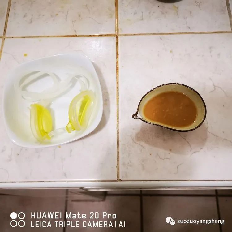 案例分享:原始点调理视力下降、视物模糊的案例 案例分享:原始点调理视力下降、视物模糊的案例