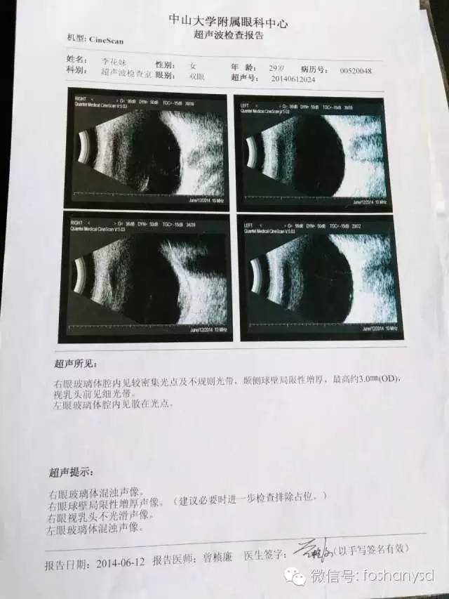 案例分享：原始点调理后减肥的案例