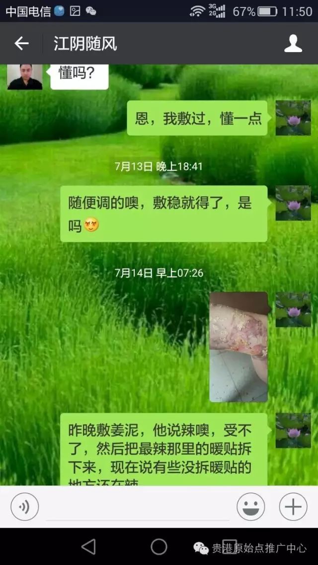 案例分享:原始点调理车祸烧伤不留疤的案例 案例分享:原始点调理车祸烧伤不留疤的案例