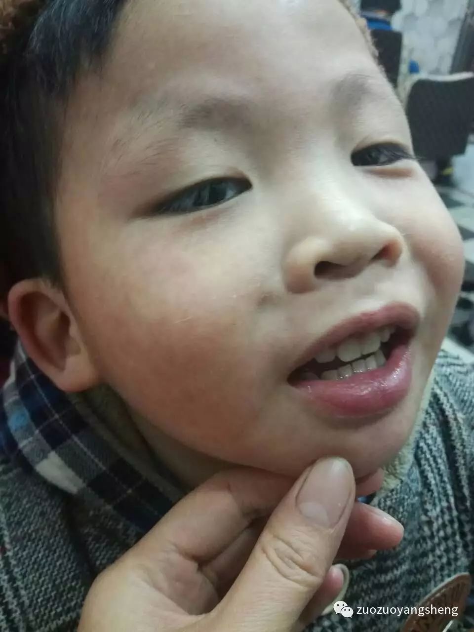 案例分享:原始点调理小朋友的婴幼儿急疹案例 案例分享:原始点调理小朋友的婴幼儿急疹案例