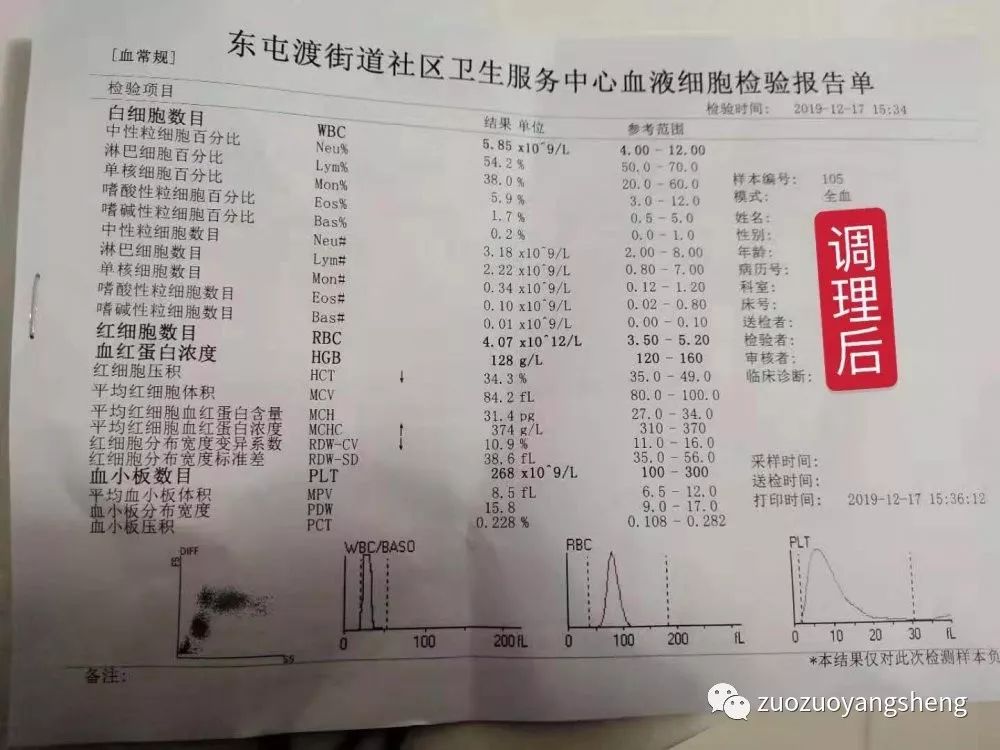 案例分享：原始点调理甲流案例