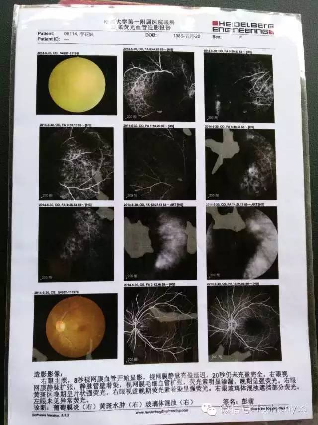 案例分享：原始点调理后减肥的案例