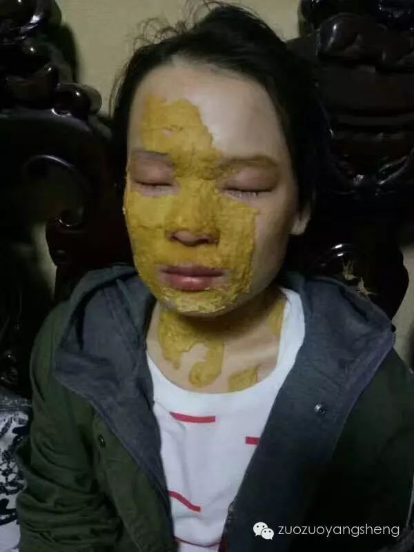 案例分享:原始点调理花季少女面部烫伤不留疤的案例 案例分享:原始点调理花季少女面部烫伤不留疤的案例