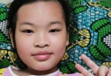 案例分享:原始点调理孩子十年便秘的案例-原始点全球同学网