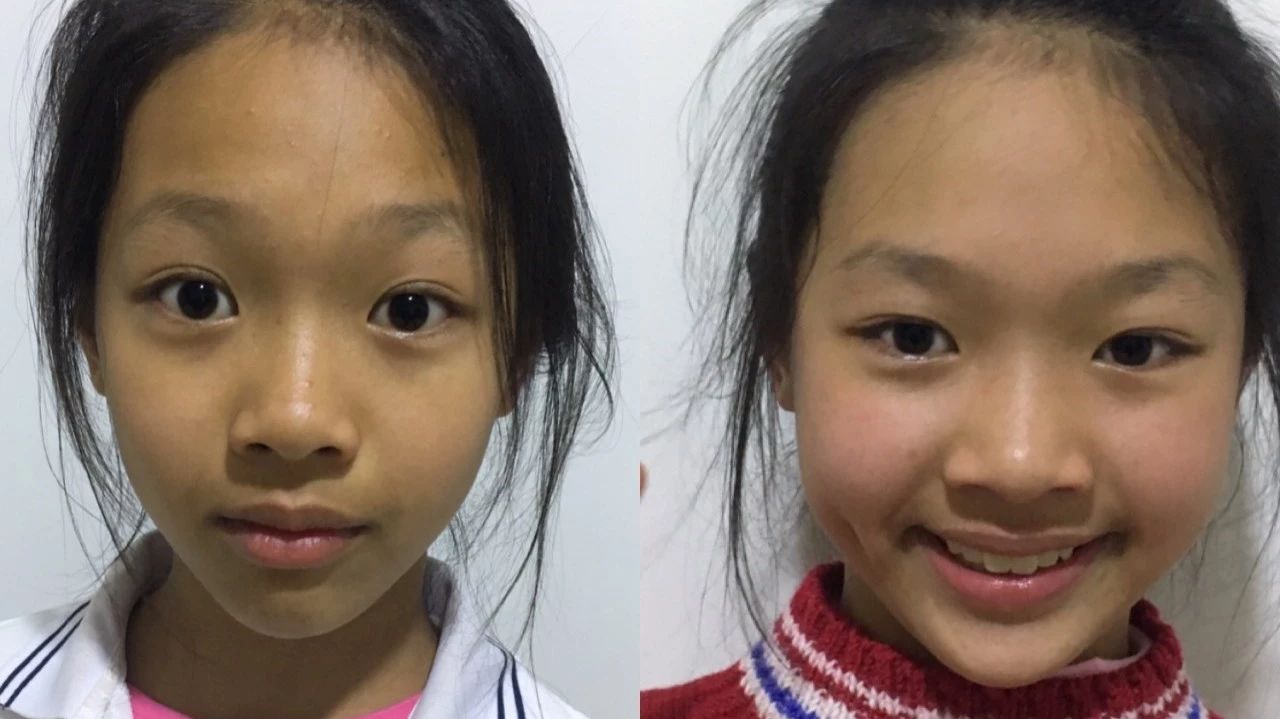 案例分享：原始点调理儿童全身痒的案例-原始点全球同学网