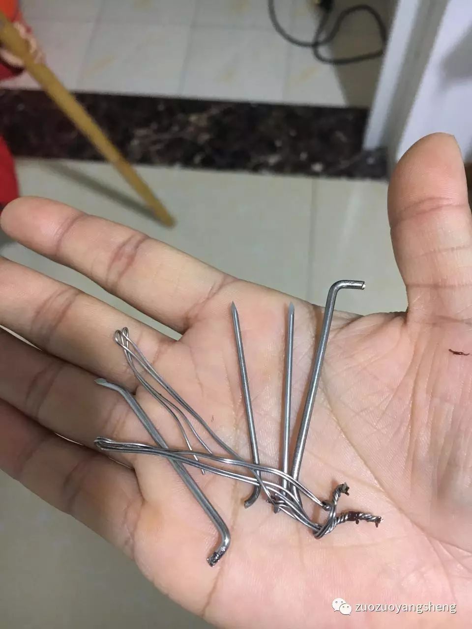 案例分享:最难度的家人——原始点调理妈妈骨折手术后的康复 案例分享:最难度的家人——原始点调理妈妈骨折手术后的康复