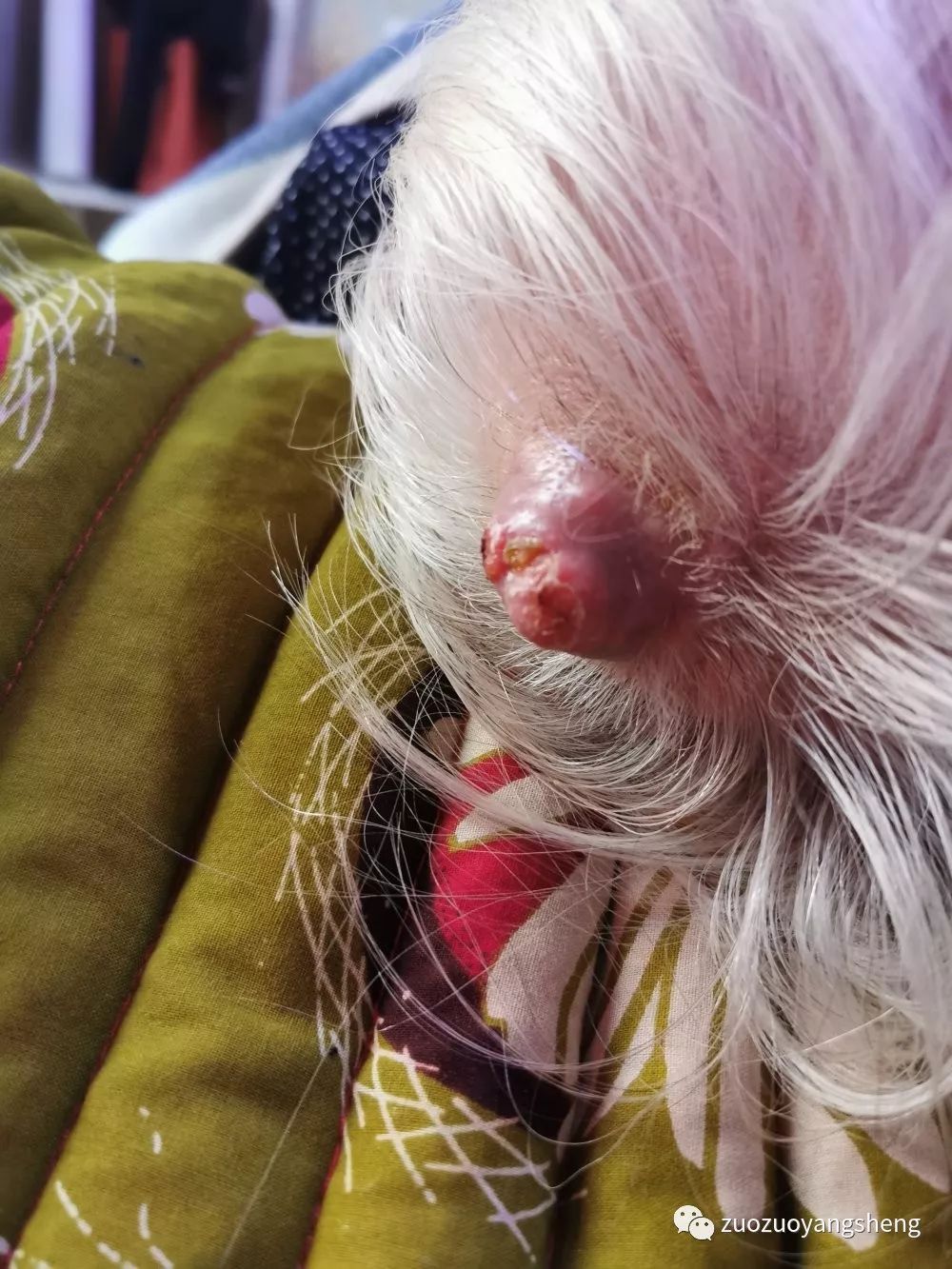 微问答143期：头部长了一个疮，里面是软的、有水，原始点要怎么处理？