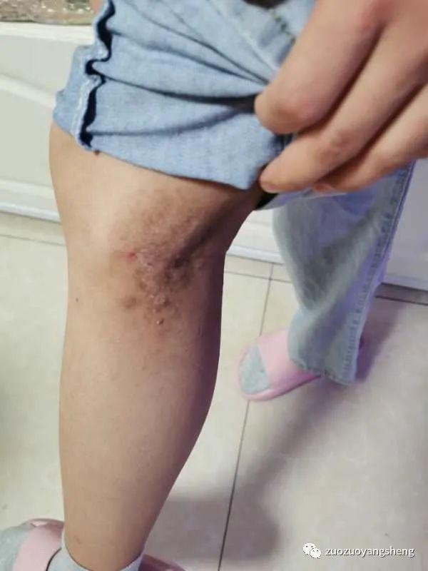 案例分享:学员李女士学习与调理的心路历程 案例分享:学员李女士学习与调理的心路历程