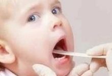 微问答167期:小孩发烧后温敷处理后,喉咙水泡化脓,流鼻血……-原始点全球同学网