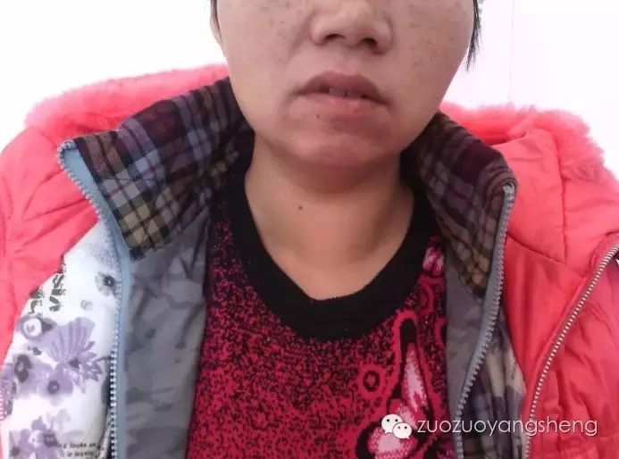 案例分享:两个癌肿瘤案例成败对比,背后的原因值得深思 案例分享:两个癌肿瘤案例成败对比,背后的原因值得深思