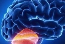 案例分享:原始点调理69岁老年人脑梗、脑萎缩,脑白质变性,高血压案例-原始点全球同学网