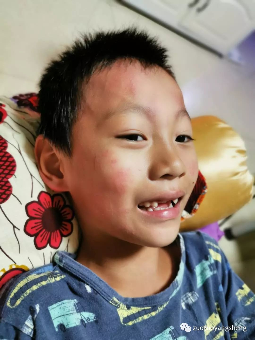 案例分享:原始点调理孩子需要做扁桃体切割手术的案例 案例分享:原始点调理孩子需要做扁桃体切割手术的案例