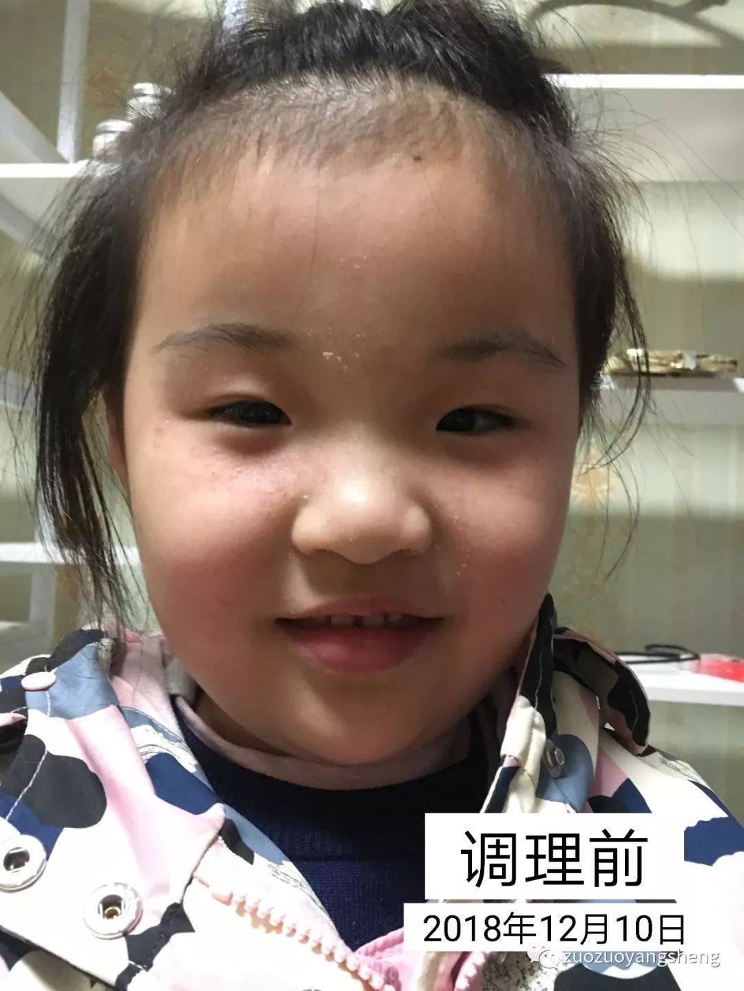 案例分享:原始点让我摆脱了打针吃药的痛苦(原始点调理两孩子哮喘、咳嗽的案例) 案例分享:原始点让我摆脱了打针吃药的痛苦(原始点调理两孩子哮喘、咳嗽的案例)