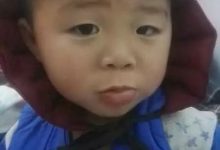 案例分享：原始点调理小朋友吃寒凉水果而嘴唇红肿的案例-原始点全球同学网