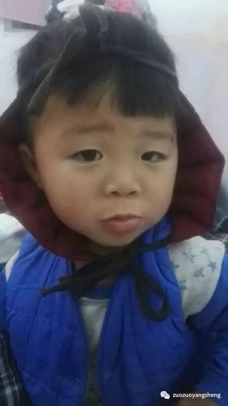案例分享：原始点调理小朋友吃寒凉水果而嘴唇红肿的案例-原始点全球同学网