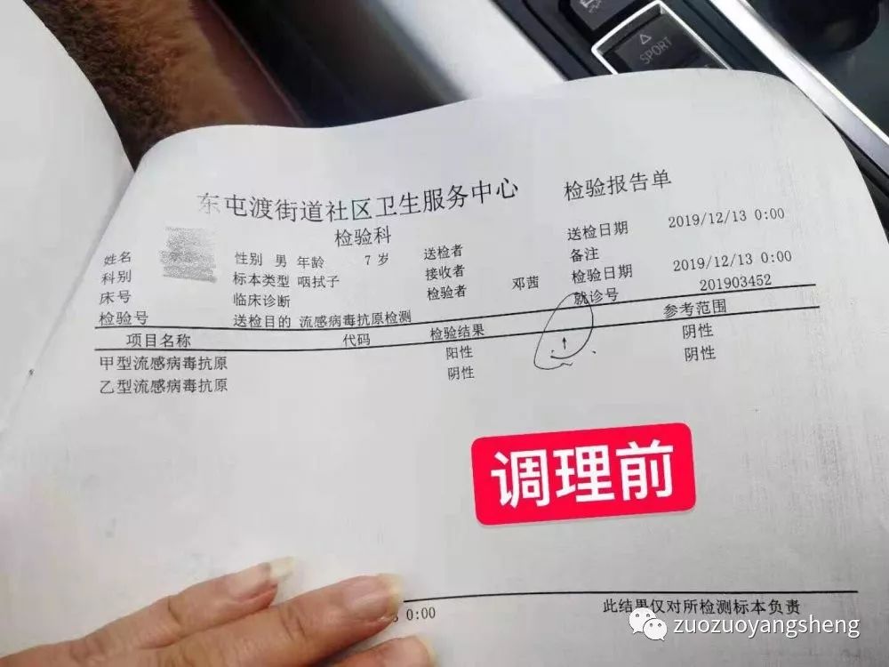 案例分享：原始点调理甲流案例