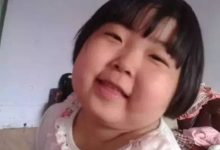 案例分享：原始点调理好服用激素和生物制剂5年的宝宝-原始点全球同学网