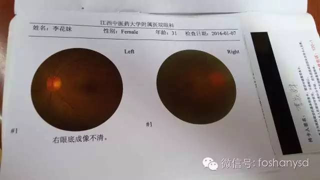 案例分享：原始点调理后减肥的案例