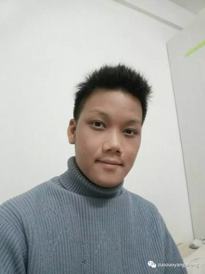 案例分享:马来西亚男孩严重湿疹,10天大变样 案例分享:马来西亚男孩严重湿疹,10天大变样