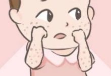 微问答162期：：孩子身上反复起疹子怎么办？-原始点全球同学网