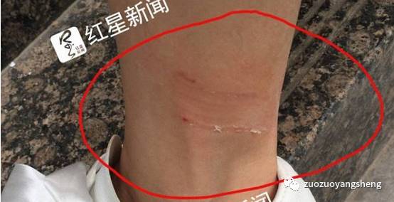 女子被狗咬28天后死 丈夫:为何打了狂犬疫苗也没用?如果学了原始点……-原始点全球同学网