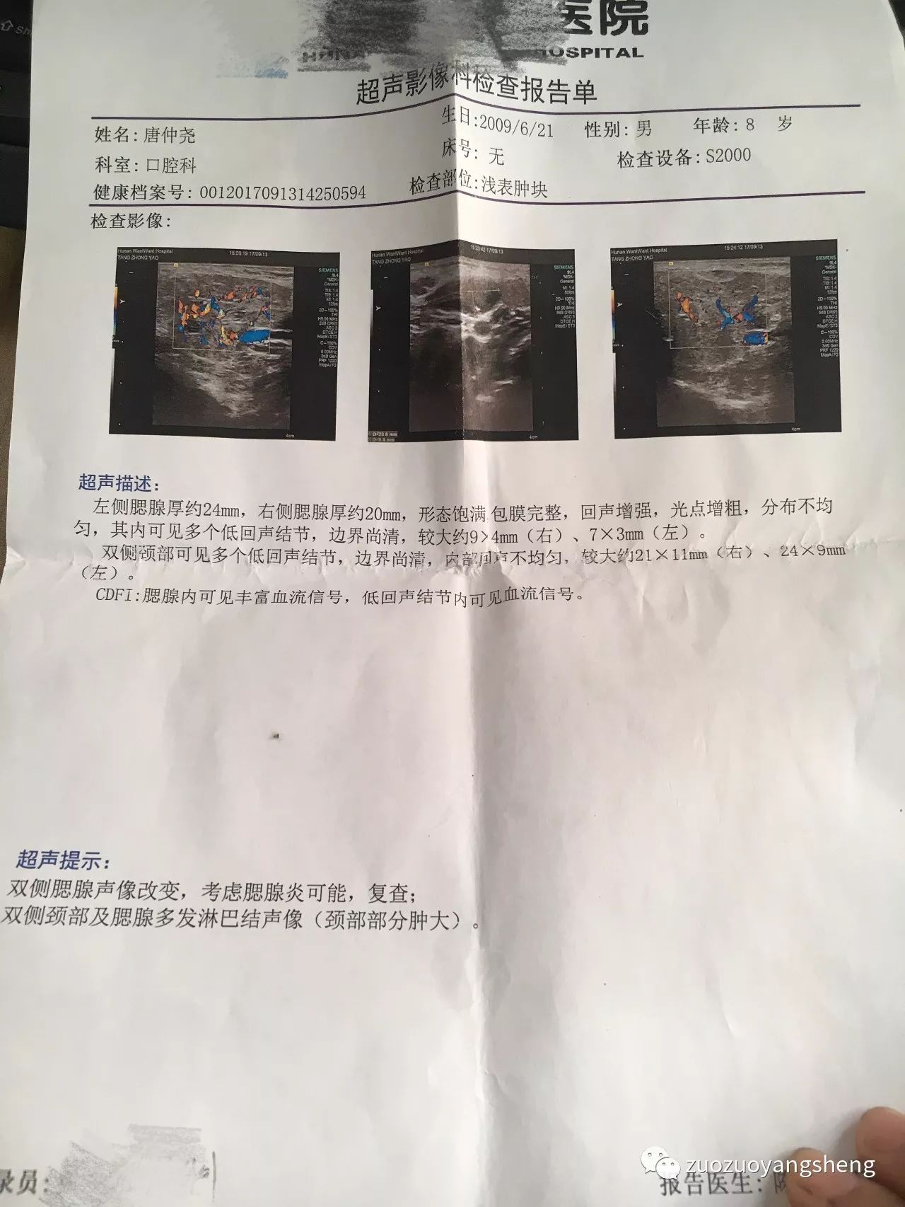 案例分享：原始点调理儿子的腮腺炎