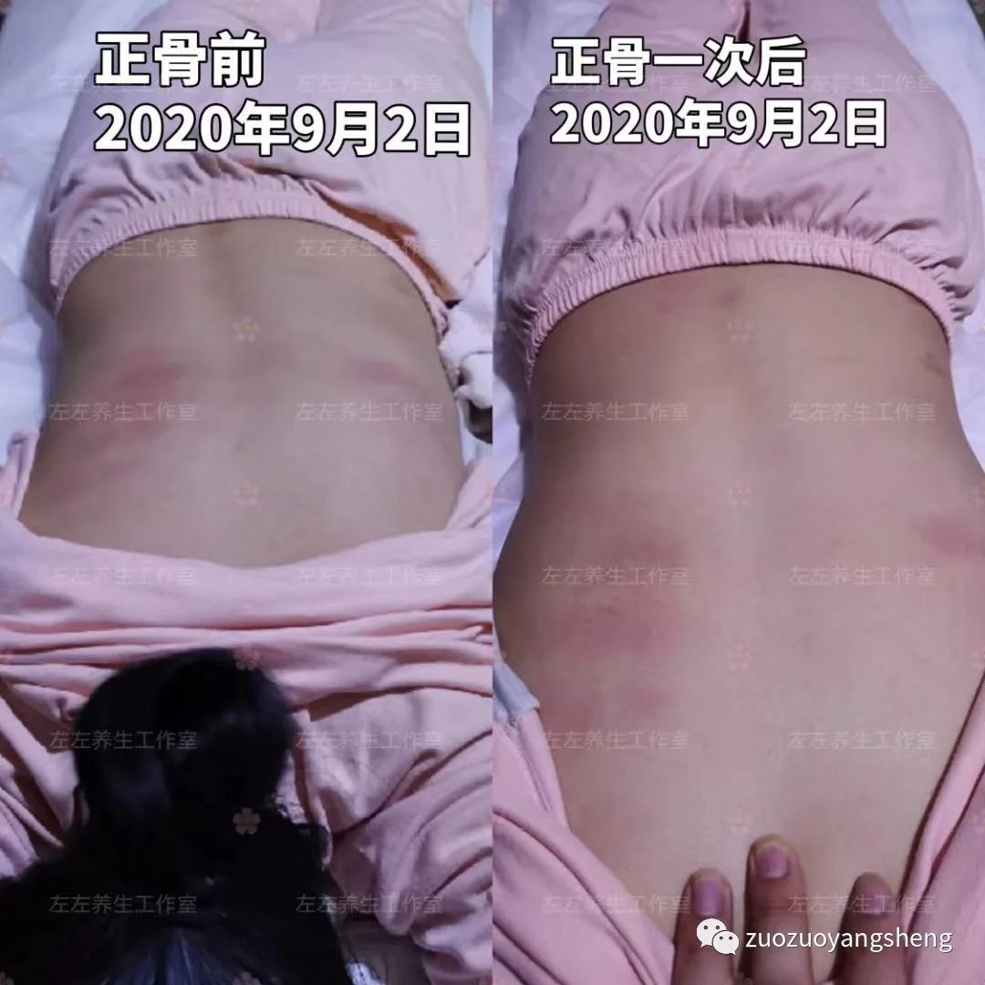 案例分享:原始点调理四十年头痛的案例 案例分享:原始点调理四十年头痛的案例