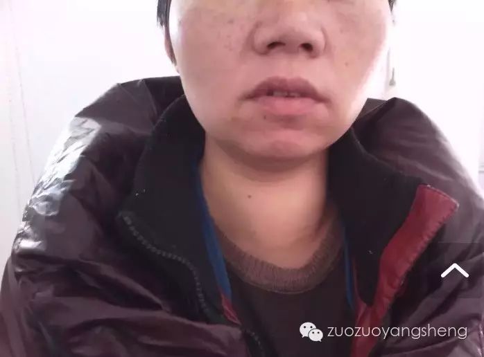 案例分享:两个癌肿瘤案例成败对比,背后的原因值得深思 案例分享:两个癌肿瘤案例成败对比,背后的原因值得深思