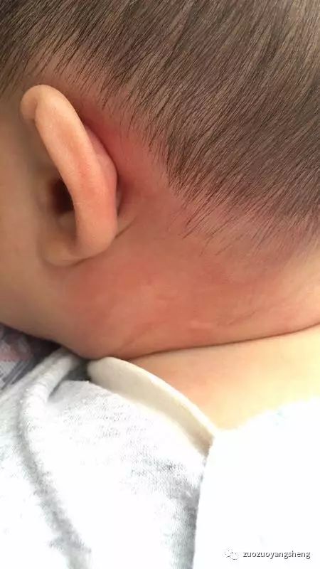 原始点调理小朋友过程中所出现的好转反应大总结 原始点调理小朋友过程中所出现的好转反应大总结