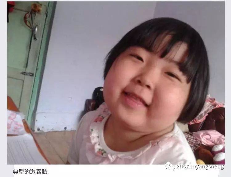 案例分享：原始点调理好服用激素和生物制剂5年的宝宝