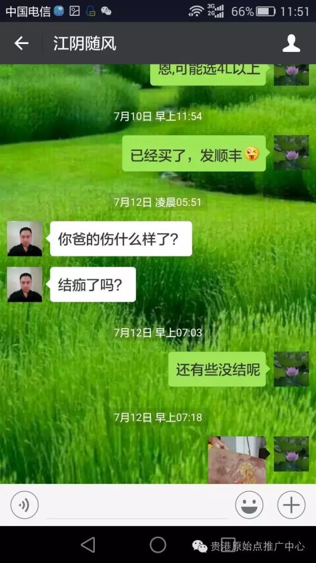 案例分享:原始点调理车祸烧伤不留疤的案例 案例分享:原始点调理车祸烧伤不留疤的案例